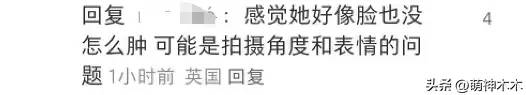 凯特王妃术后首露面！面颊圆润鼻子变塌惹质疑，威廉王子反应心虚